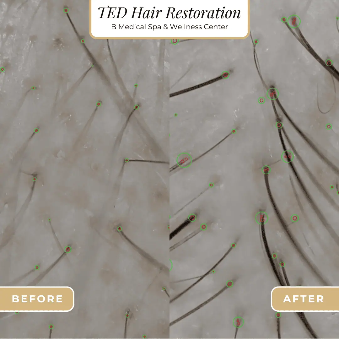 Beforafter-B-Medical-Spa-and-Wellness-Center-San-Diego-CA
