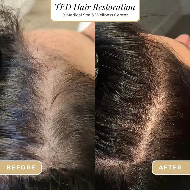ted_beforeafter-in-San-Diego-CA