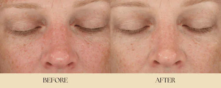 diamond-glow-by-B-Medical-Spa-and-Wellness-Center-San-Diego-CA