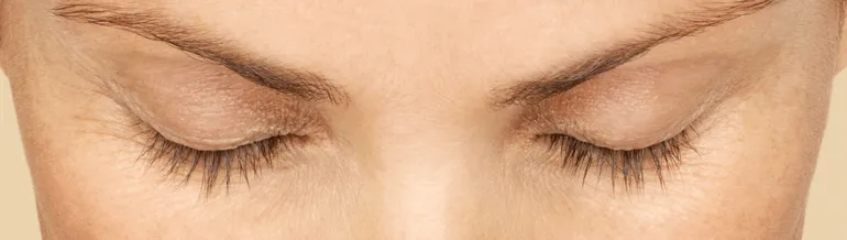 Latisse-Latisse-after-product-B-Medical-Spa-and-Wellness-Center-San-Diego-CA