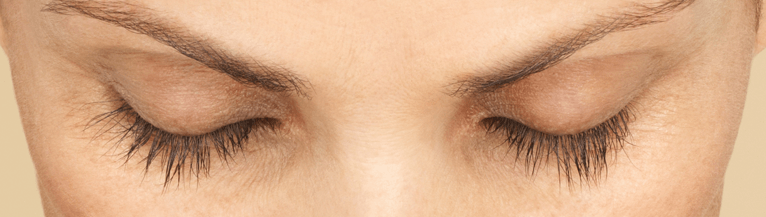 Latisse-after-product-B-Medical-Spa-and-Wellness-Center-San-Diego-CA